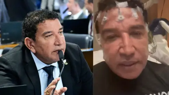 Técnica de enfermagem acusa Magno Malta de agressão em hospital de Brasília