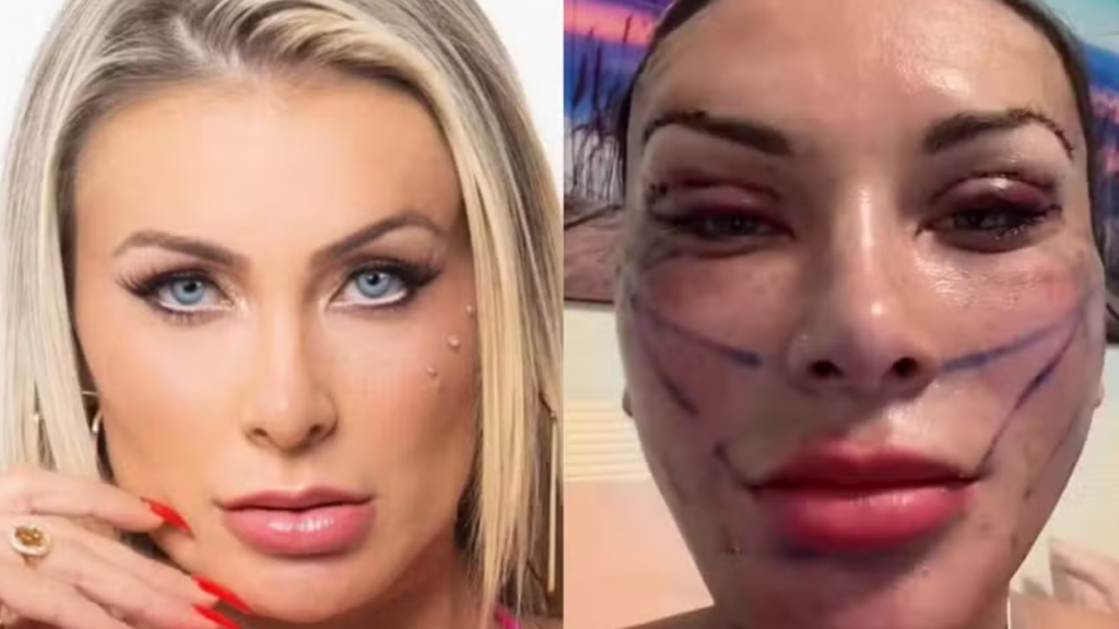 Vídeo: Andressa Urach exibe novo rosto após cirurgias e diz que rejuvenesceu 15 anos