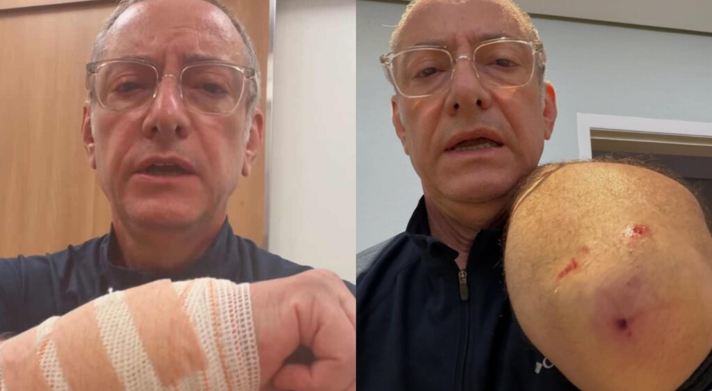 Âncora da Globo é atacado por pitbull durante passeio em SP