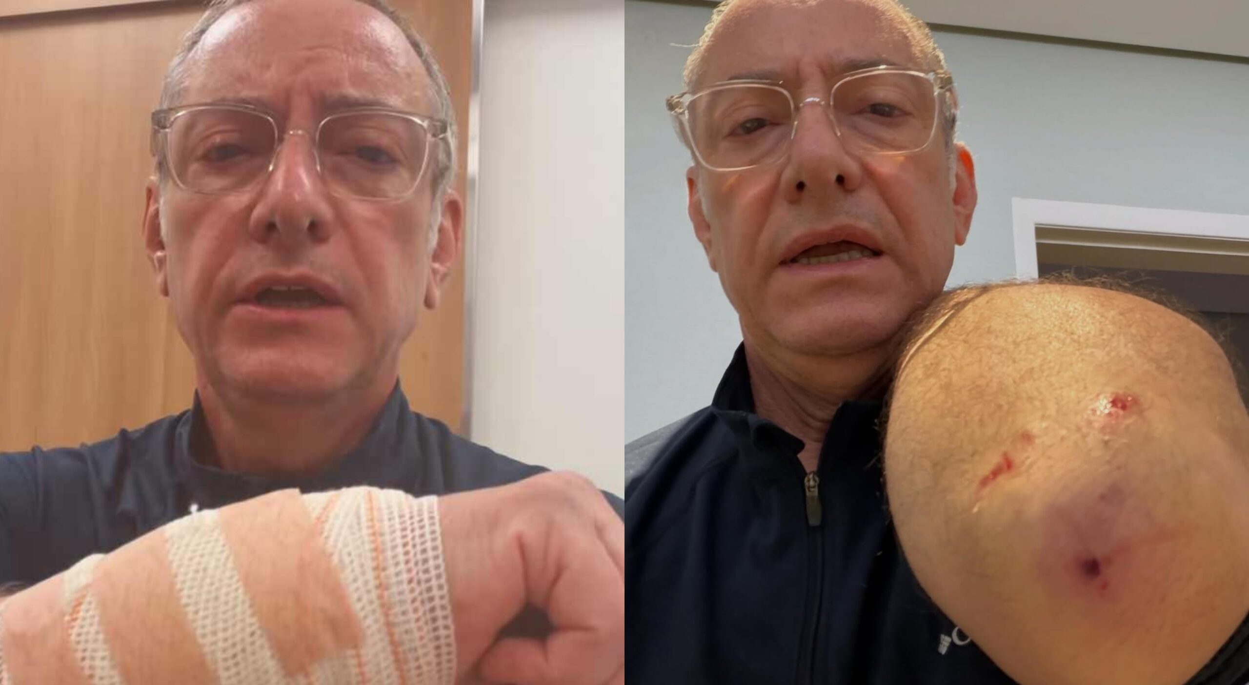 Âncora da Globo é atacado por pitbull durante passeio em SP