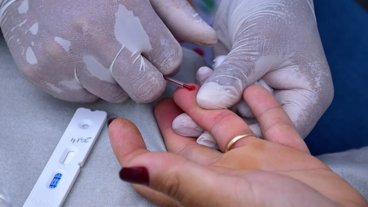 Órion Complex e Prefeitura oferecem testes gratuitos de hepatite nesta quarta-feira (08/07) em Goiânia
