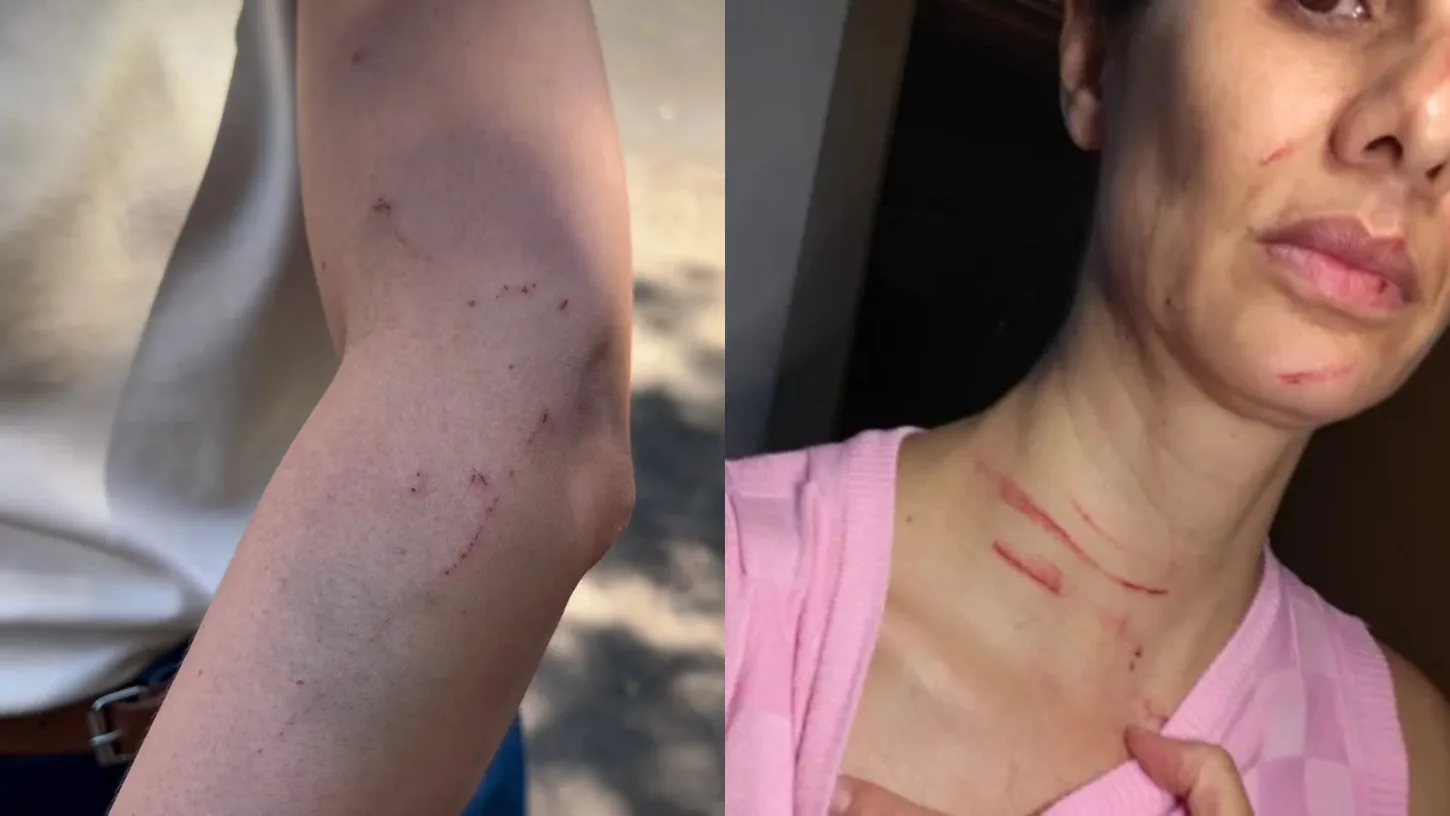 Enfermeira de Anápolis é agredida no DF após informar que hospital não tinha vagas para atendimento