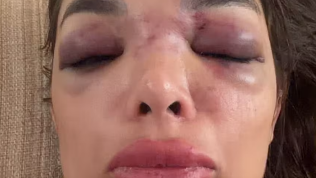 Vídeo: Mulher denuncia marido empresário da Faria Lima por agressões e suspeito é preso em flagrante