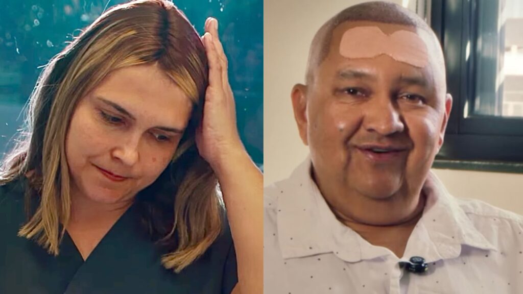 Transplante capilar vai além da aparência, fortalece autoestima e bem-estar