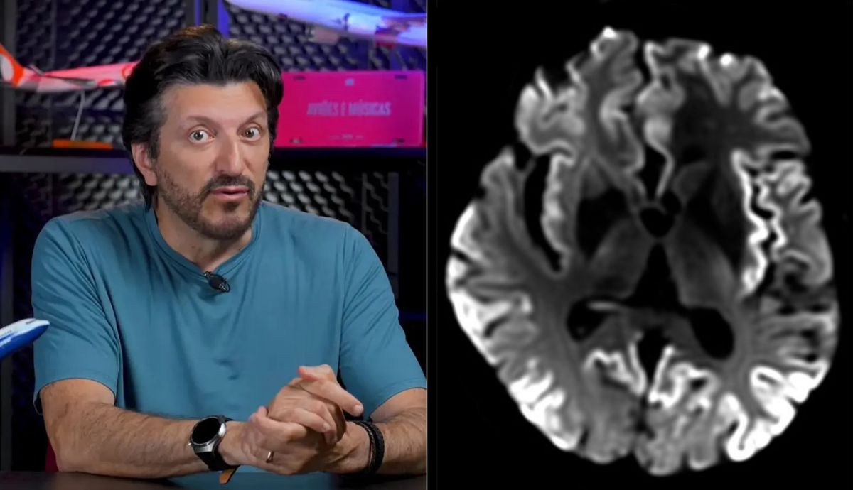 Piloto e influenciador Lito Sousa é diagnosticado com doença rara e fatal
