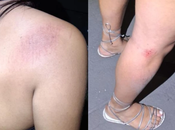 Jovem denuncia agressão e atropelamento após discussão por conta de conta em bar de Anápolis