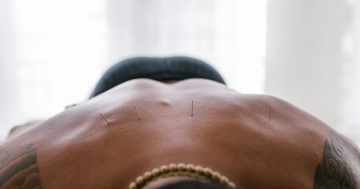 As 10 melhores clínicas de acupuntura em Goiânia em 2026