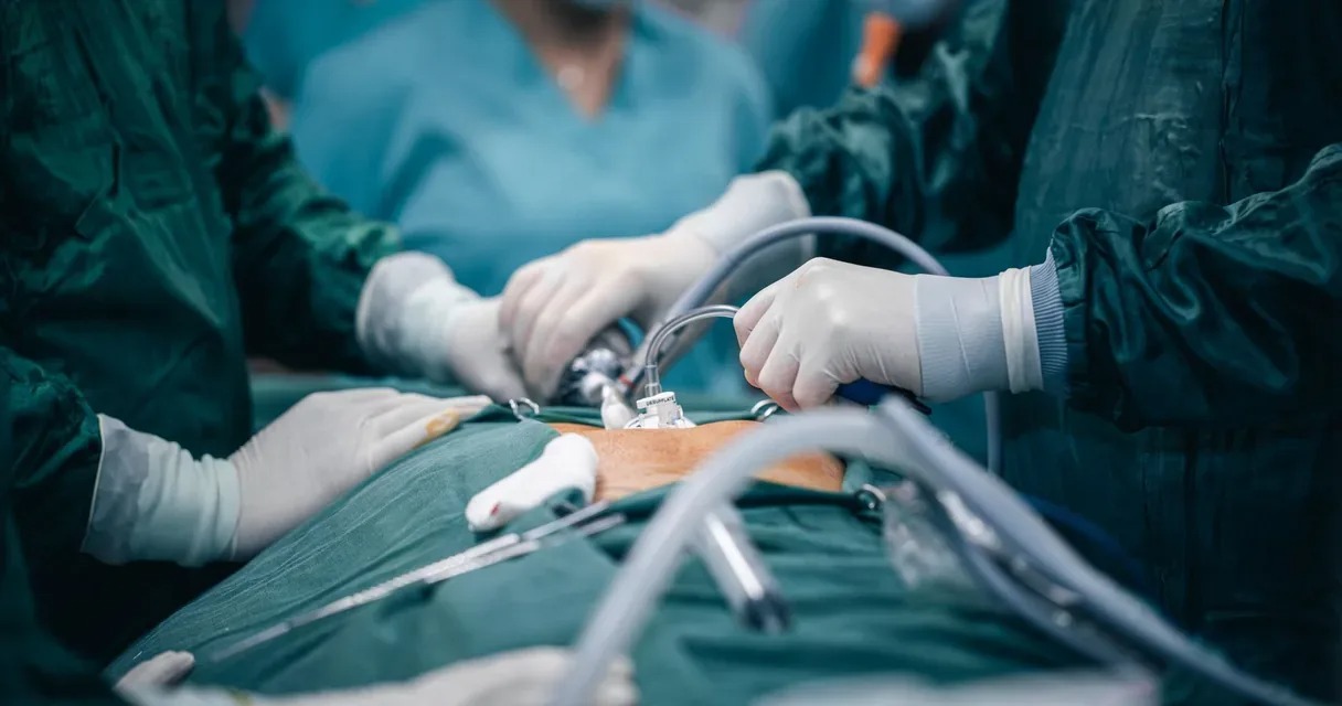 Desfazer cirurgia bariátrica: quando a reversão do bypass é indicada