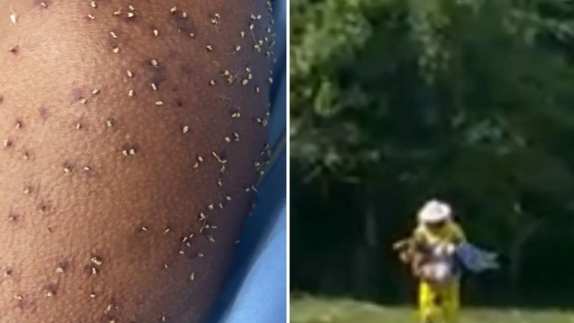 Homem sofre choque anafilático após ataque de enxame de abelhas em Itapuranga