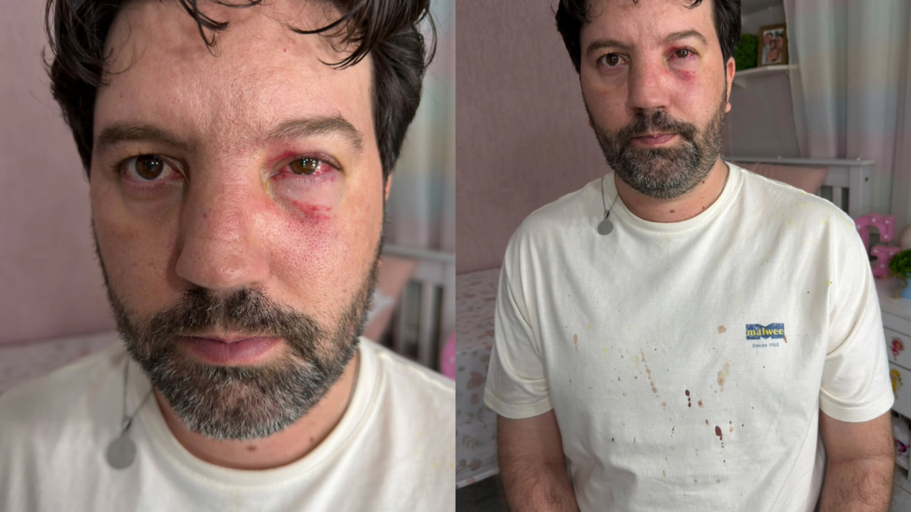 Vídeo: Radialista relata agressão durante cobertura de jogo entre São Luís e Goianésia